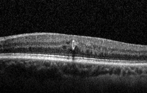 XXII Congreso – PEVAC | Fundus S.A. Laboratorio de Diagnóstico por ...